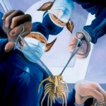 Surgical Nightmare